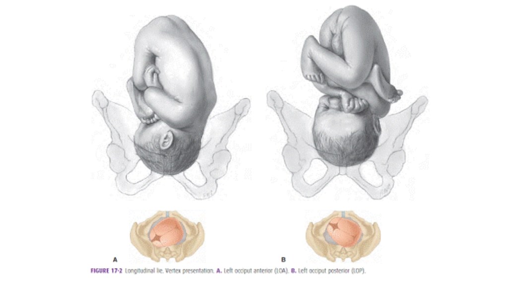 รูปปากมดลูกเปิด ภาพจากเว็บไซต์คณะแพทยศาสตร์ มหาวิทยาลัยเชียงใหม่