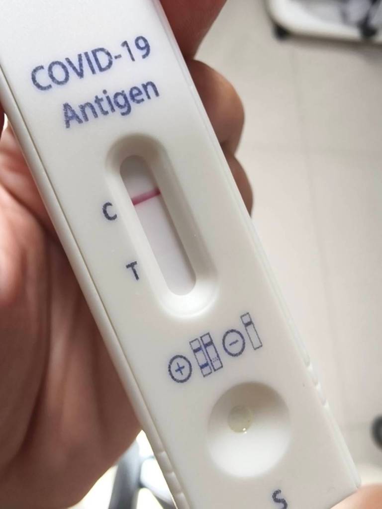 อาการโควิดล่าสุด ATK